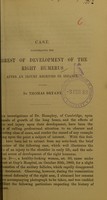 view Case illustrating the arrest of development of the right humerus after an injury received in infancy / by Thomas Bryant.