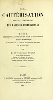 view De la cautérisation dans le traitement des maladies chirurgicales : thèse présentée au concours pour l'agrégation (section de chirurgie) et soutenue à la Faculté de médecine de Paris le 26 mai 1869 / par Théophile Anger.