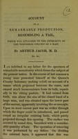 view Account of a remarkable production, resembling a tail, which was attached to the extremity of the vertebral column of a man / by Arthur Jacob.