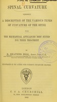 view Spinal curvature : comprising a description of the various types of curvature of the spine with the mechanical appliances best suited for their treatment / by R. Heather Bigg ; illustrated by the author.