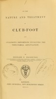 view On the nature and treatment of club-foot and analogous distortions involving the tibio-tarsal articulation / by Bernard E. Brodhurst.