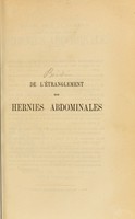 view De l'étranglement dans les hernies abdominales et des affections qui peuvent le simuler : thèse de concours pour l'agrégation en chirurgie (1853) / par Paul Broca.