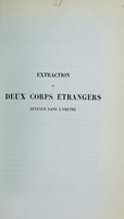 view Extraction de deux corps étrangers retenus dans l'urètre / par Alph. Amussat.