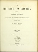 view Das Steinkind von Leinzell : Inaugural-Abhandlung zur Erlangung der Doctorwürde in der Medicin und Chirurgie unter dem Vorsitz von Dr. Hubert Luschka ... vorgelegt / von Wilhelm Kieser.