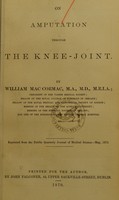 view On amputation through the knee-joint / by William Mac Cormac.