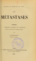 view Des métastases : thèse présentée au concours pour l'agrégation (section de médecine et de médecine légale) / par E. Quinquaud.