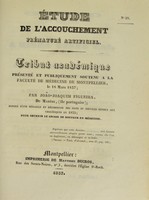 view Étude sur l'accouchement prématuré artificiel : tribut académique présenté et publiquement soutenu à la Faculté de médecine de Montpellier, le 18 mars 1837 / par João-Joaquim Figueira.