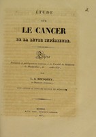 view Étude sur le cancer de la lèvre inférieure : thèse présentée et publiquement soutenue à la Faculté de médecine de Montpellier, le [...] août 1837 / par L.A. Bousquet.