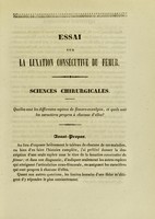 view Essai sur la luxation consécutive du fémur ... : thèse présentée et publiquement soutenue à la Faculté de médecine de Montpellier, le 6 juillet 1838 / par Charles Biernacki.