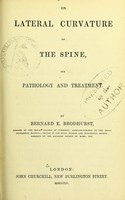 view On lateral curvature of the spine : its pathology and treatment / by Bernard E. Brodhurst.