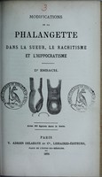 view Modifications de la phalangette dans la sueur, le rachitisme et l'hippocratisme / Dr Esbach.