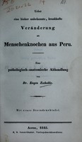 view Ueber eine bisher unbekannte, krankhafte Veränderung an Menschenknochen aus Peru : eine pathologisch-anatomische Abhandlung / von Eugen Zschokke.