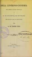 view Della litotripsio-cistotomia nei grossi calculi vescicali e di un dito metallico articolato per alcuni casi di cistotomia : nota / del Prof. Francesco Rizzoli.