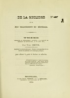 view De la scoliose et de son traitement en général : thèse présentée et publiquement soutenue à la Faculté de médecine de Montpellier, le 30 août 1841 / par Numa Ortus.