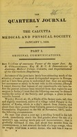 view Case of enormous tumor of the upper jaw / by R. O'Shaughnessy.