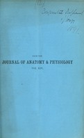 view Notes on the dissection of a case of congenital dislocation of the head of the femur / by Francis J. Shepherd.