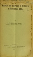 view Exhibition and description of the skull of a microcephalic Hindu / by R.W. Reid.