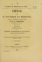 view Considérations sur les lésions traumatiques du rachis et de la moelle épinière : thèse pour le doctorat en médecine, présentée et soutenue le 3 juillet 1852, par N.-P. Schveing.