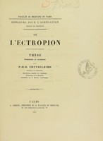 view De l'ectropion : thèse / présentée et soutenue par P.-E.-G. Cruveilhier.