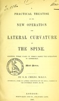 view A practical treatise on the new operation for lateral curvature of the spine : showing those cases in which alone the operation is admissible / by G.B. Childs.