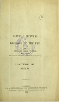 view Clinical lectures on diseases of the eye. Lecture III. Squint / by Charles Bell Taylor.