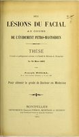 view Des lésions du facial au cours de l'évidement petro-mastoïdien : thèse présentée et publiquement soutenue à la Faculté de médecine de Montpellier le 24 mars 1903 / par Joseph Rigal.