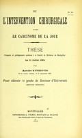 view De l'intervention chirurgicale dans le carcinome de la joue : thèse présentée et publiquement soutenue à la Faculté de médecine de Montpellier le 11 juillet 1904 / par Antoine Kypriotis.