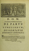 view De partu gemellorum : dissertatio anatomico-chirurgica, quam, Deo juvante, & praeside M. Petro Sue, secundo ... / tueri conabitur Jacobus Guilbert.