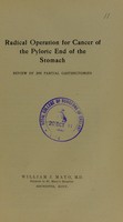 view Radical operation for cancer of the pyloric end of the stomach : review of 266 partial gastrectomies / William J. Mayo.
