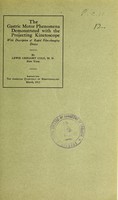 view The gastric motor phenomena demonstrated with the projecting kinetoscope : with description of rapid film-changing device / by Lewis Gregory Cole.