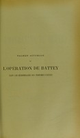 view Valeur actuelle de l'opération de Battey dans les hémorragies des fibromes utérins : thèse présentée et publiquement soutenue devant la Faculté de médecine de Montpellier le 26 juillet 1913 / par Lazare Vartazaroff.