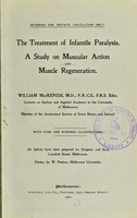 view The treatment of infantile paralysis : a study on muscular action and muscle regeneration / William MacKenzie.