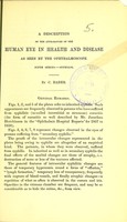 view A description of the appearance of the human eye in health and disease as seen by the ophthalmoscope. Fifth series. Syphilis / by C. Bader.