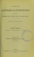 view A case of nephro-lithotomy, or the extraction of a calculus from an undilated kidney / by Henry Morris.