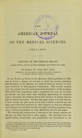 view Sarcoma of the female breast : based upon a study of one hundred and fifty-six cases / by Samuel W. Gross.