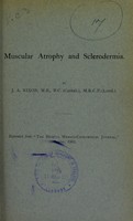 view Muscular atrophy and sclerodermia / by J.A. Nixon.