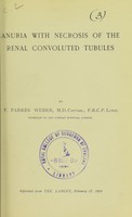 view Anuria with necrosis of the renal convoluted tubules / by F. Parkes Weber.