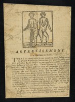 view Advertisement : To all gentlemen and ladies . There are newly arriv'd two monstrous girls, being one of the greatest wonders in nature that was ever seen ; they were born with their backs fasten'd to one another, and the passages of their bodies are both one way ...