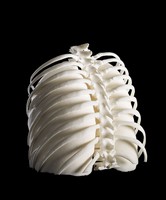 view Lungs in ribcage, Hodgkin lymphoma patient, 3D printed nylon.