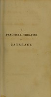 view A practical treatise on cataract / by John Stevenson.