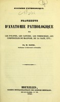 view Anatomie pathologique : fragments d'anatomie pathologique sur les polypes, les cancers, les tubercules, les corpuscules de Malpighi, de la rate, etc. / par M. Gluge.