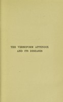 view The vermiform appendix and its diseases / by Duncan Macartney.