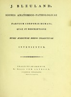 view Icones anatomico-pathologicae partium corporis humani : quae in descriptione Musei Academiae Rheno-Trajectinae inveniuntur / J. Bleuland.