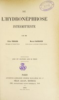 view De l'hydronéphrose intermittente / par Felix Terrier, Marcel Baudouin.