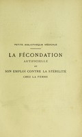 view La fécondation artificielle : et son emploi contre la stérilite chez la femme / par Jules Gautier.