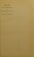 view Moles, or birth-marks, and their signification to man and woman / by Maud Wheeler.