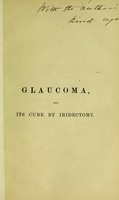 view Glaucoma, and its cure by iridectomy : being four lectures delivered at the Middlesex Hospital / by J. Soelberg Wells.