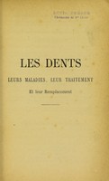 view Les dents : leurs maladies, leur traitement, et leur remplacement ... / par A. Préterre.