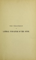 view Observations on the treatment of lateral curvature of the spine : pointing out the advantages to be gained by placing the body in a position to produce lateral flexion of the vertebral column, combined with the after application of firm mechanical support / by Edward F. Lonsdale.