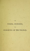 view A treatise on corns, bunions, and ingrowing of the toenail : their cause and treatment / by T.J. Ashton.